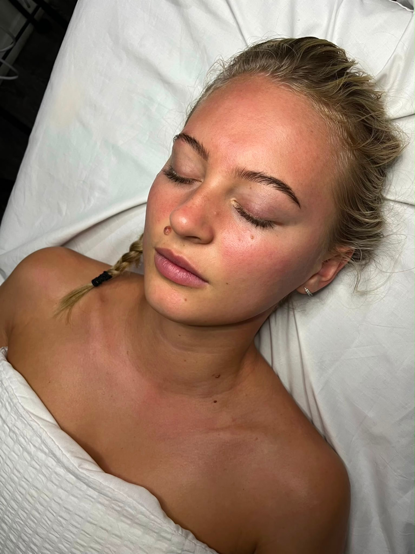Hydrofacial Sevenoaks