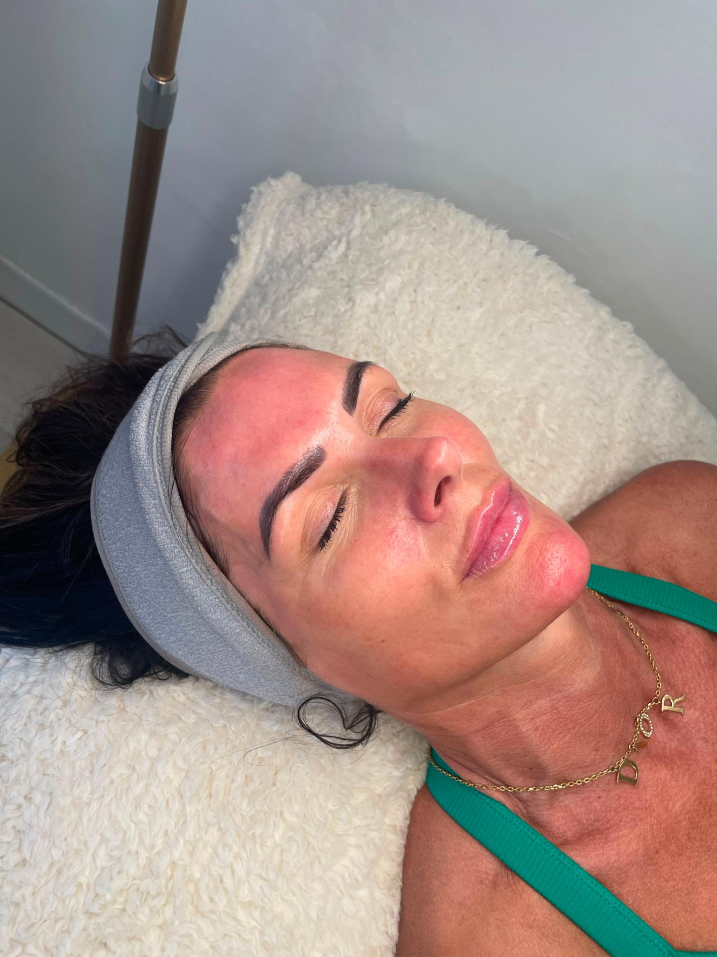 Client resting after a facial with visible temporary post-treatment redness