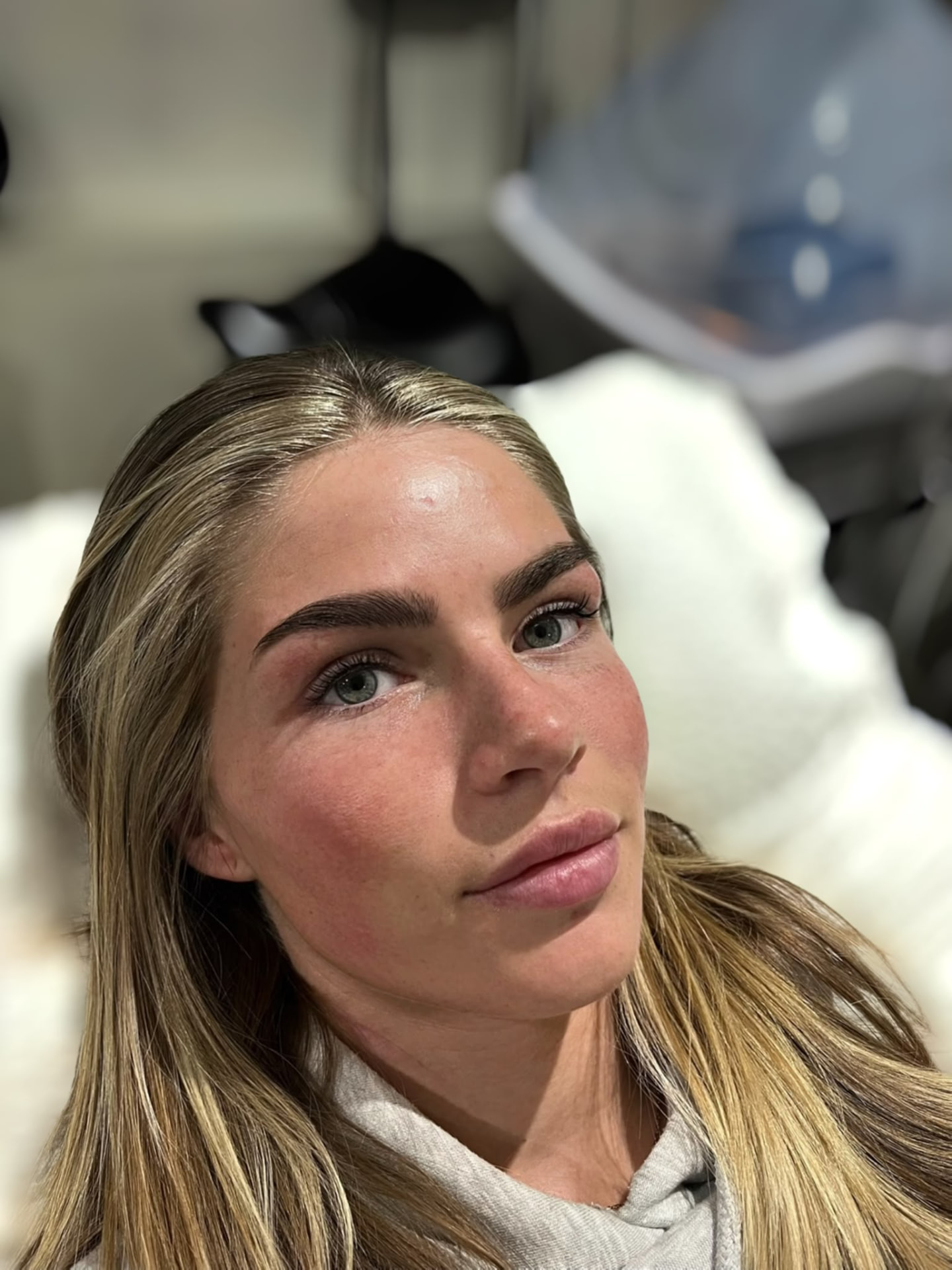 Client with a smooth radiant complexion following a professional skin treatment