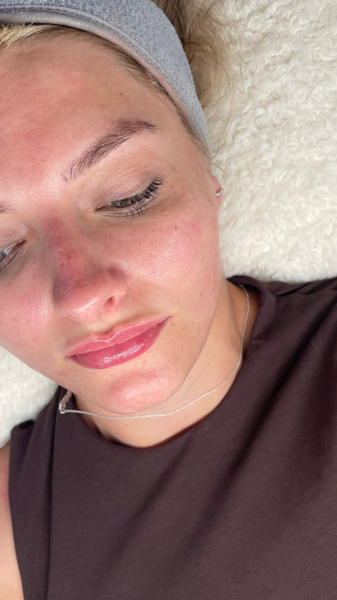 Client showing a fresh glow and temporary redness immediately after a facial