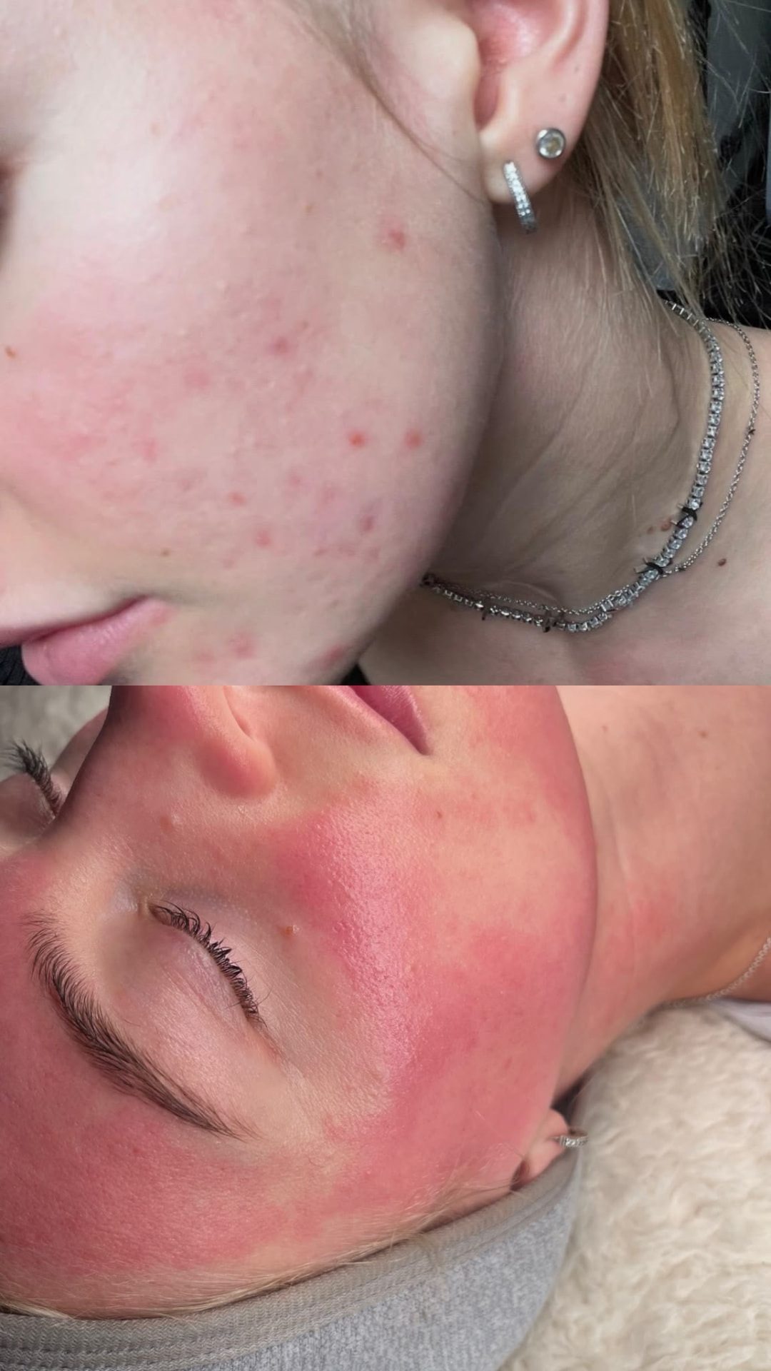 Signature Blemish Banish