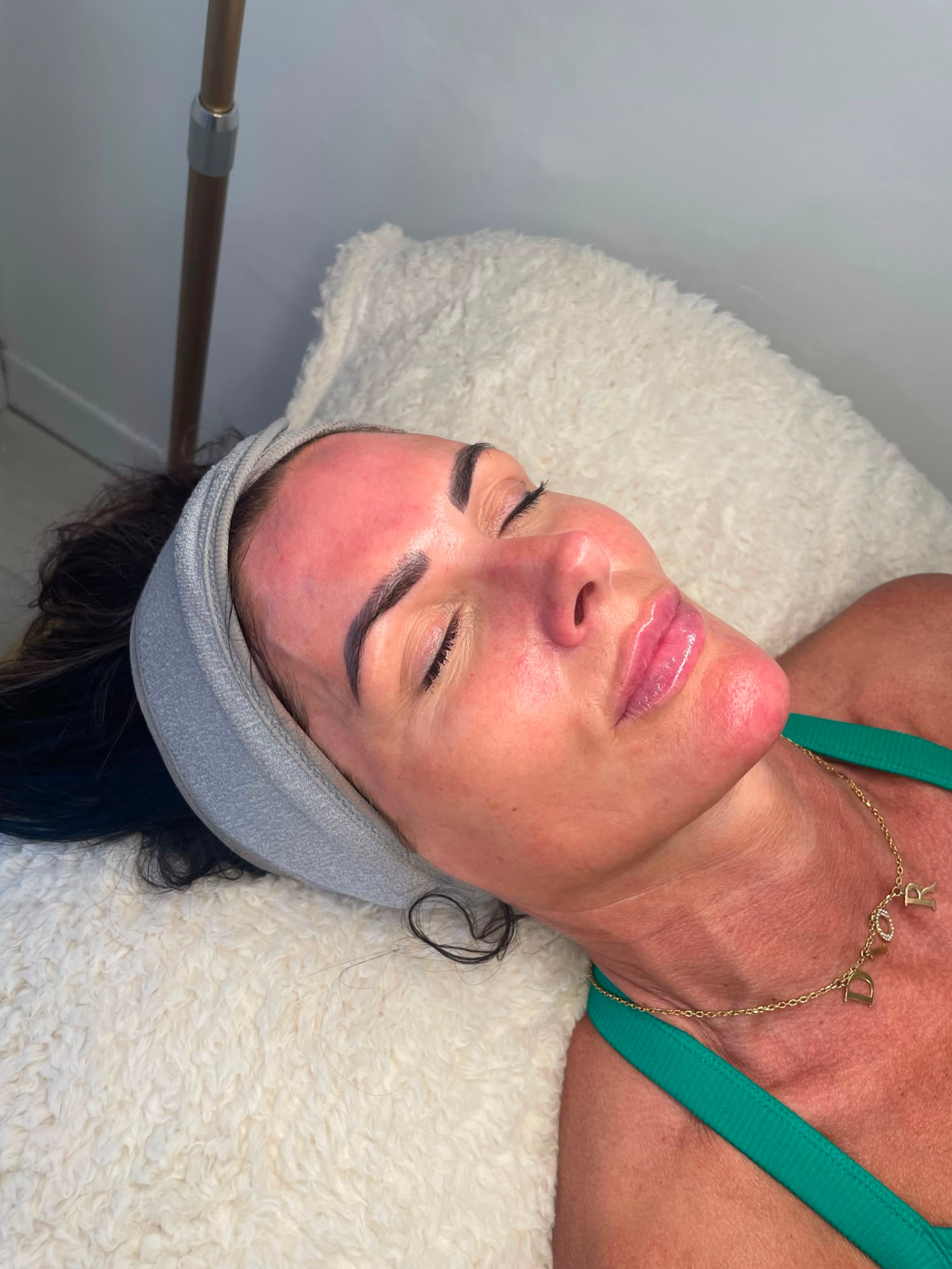 Hydro Facial in Sevenoaks