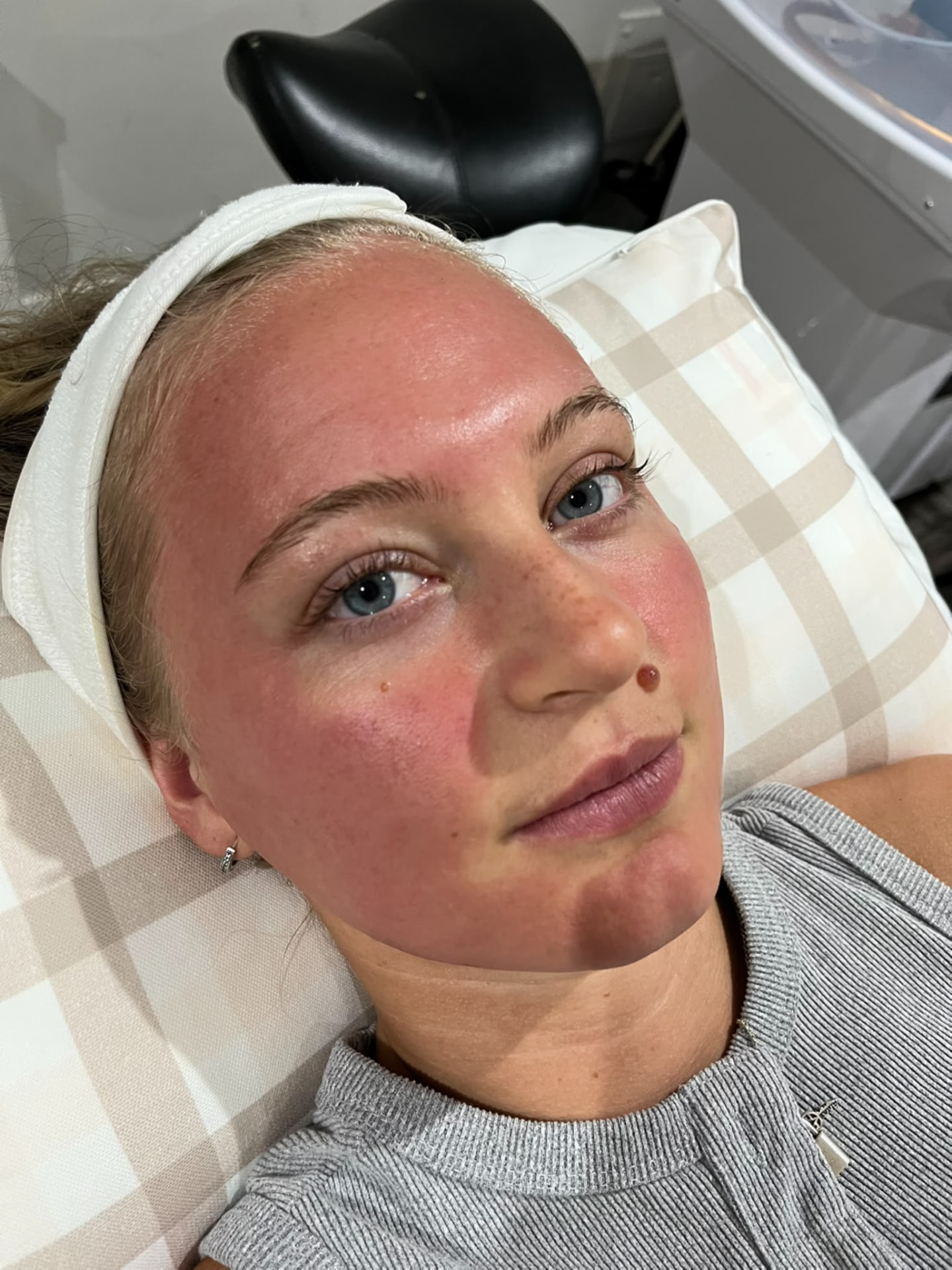 Client immediately after a facial with a fresh glow and temporary skin redness